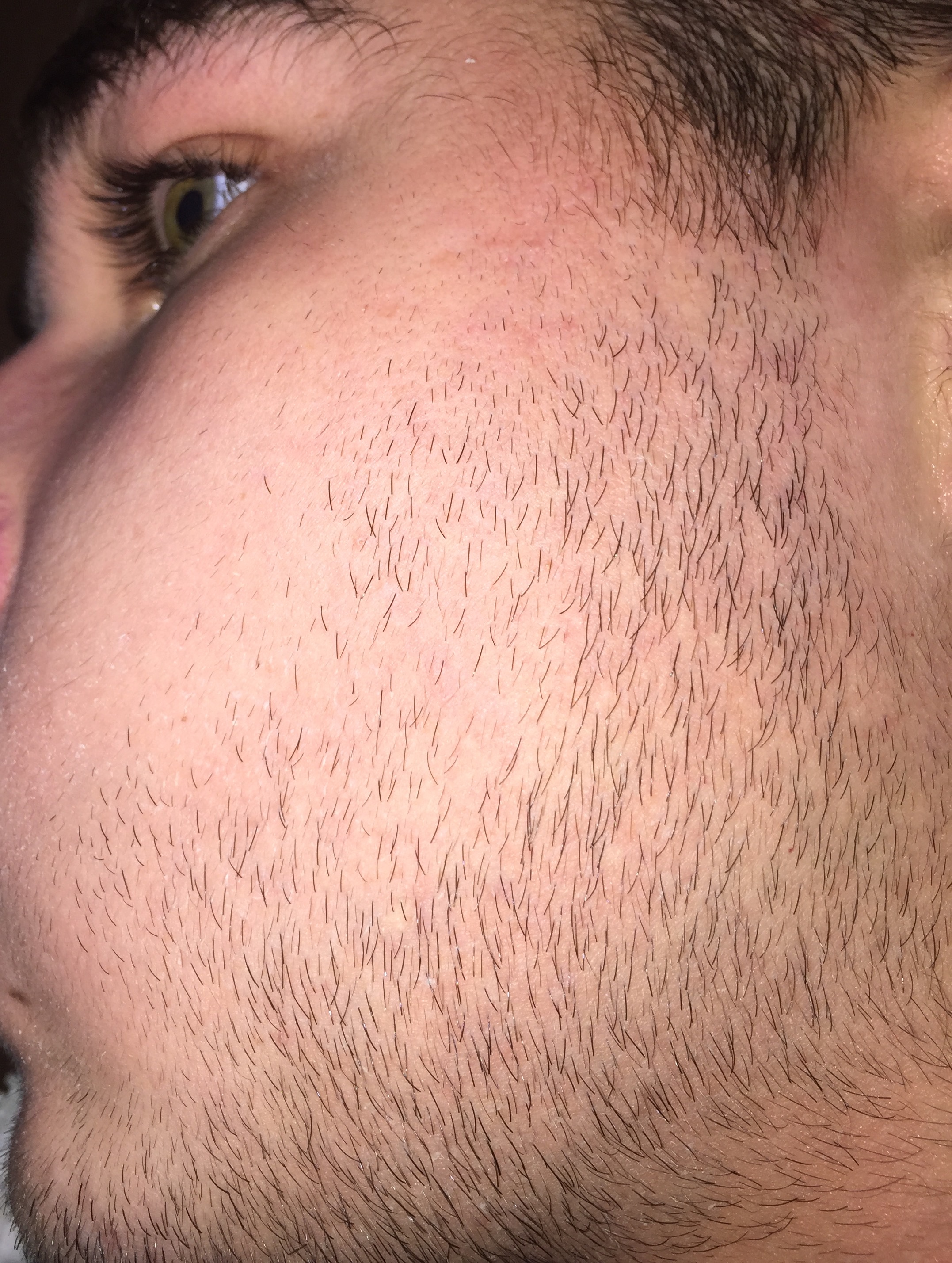 грудь у мужчин на бороде фото 102